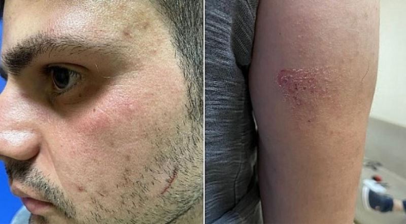 Ergani de 3 sağlıkçıya darp ! 